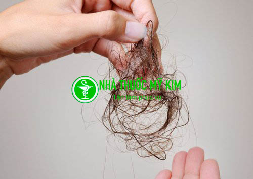 Rụng tóc nhiều là dấu hiệu bệnh gì - Bệnh rụng tóc có nguy hiểm hay không - Cách điều trị rụng tóc