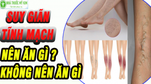 Suy tĩnh mạch nên và không nên ăn gì- Cách chữa suy giãn tĩnh mạch