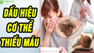 Dấu hiệu bệnh thiếu máu thiếu sắt- Cách bổ sung sắt nhanh nhất