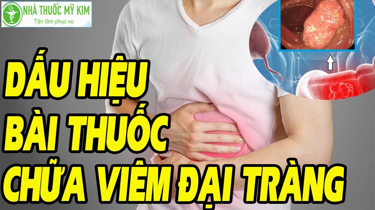 Bảng mô tả dấu hiệu viêm đại tràng cần được chú ý và theo dõi
