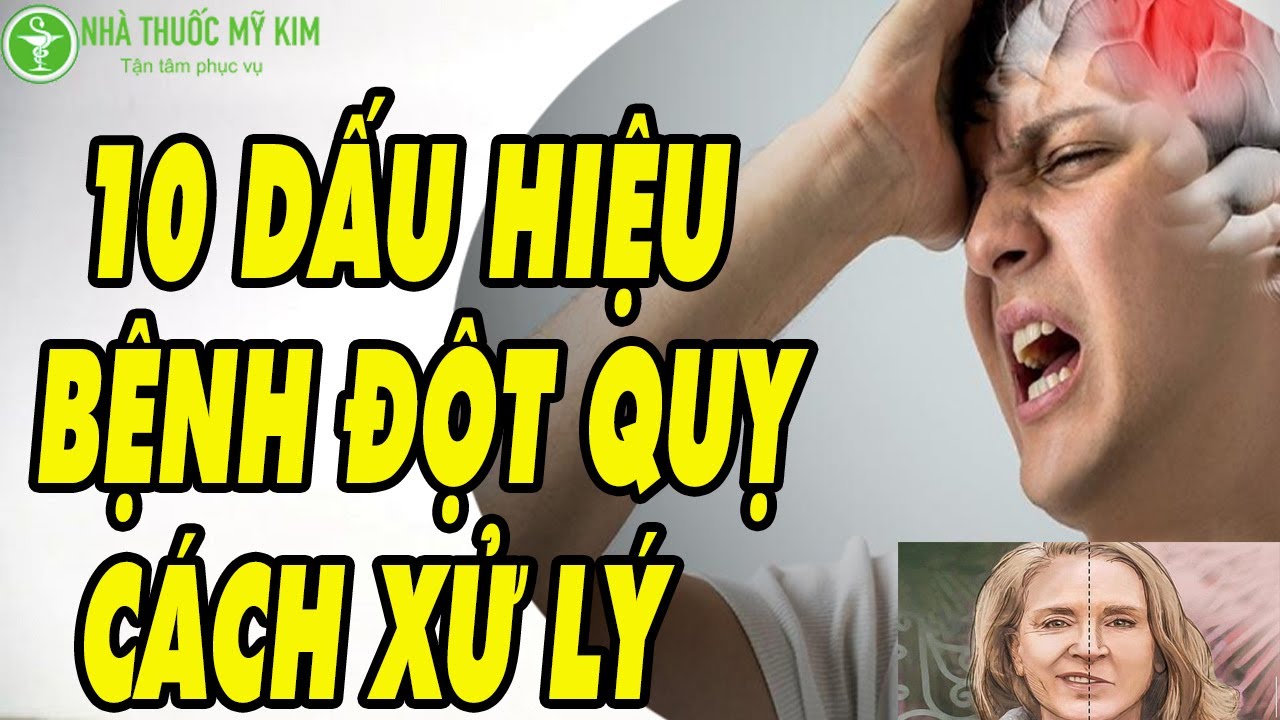 Sơ đồ thông tin minh họa các dấu hiệu đột quỵ cần nhận biết sớm để phòng tránh và xử lý kịp thời.