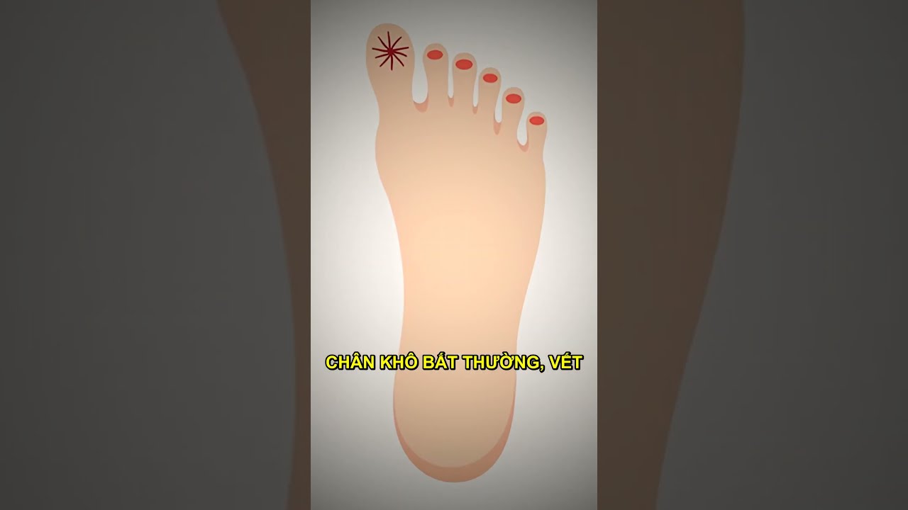kiểm tra dấu hiệu tiểu đường ở bàn chân, tuần hoàn kém