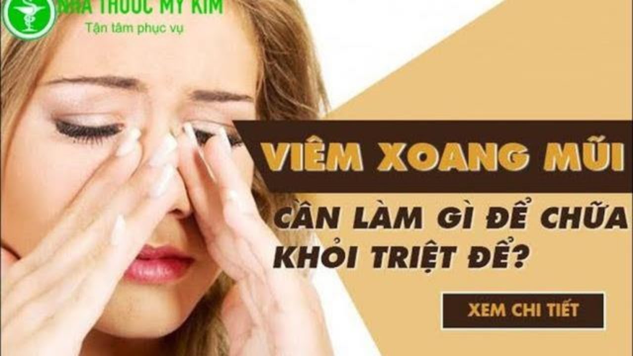 Bảng tổng hợp các triệu chứng viêm xoang mũi cần chú ý