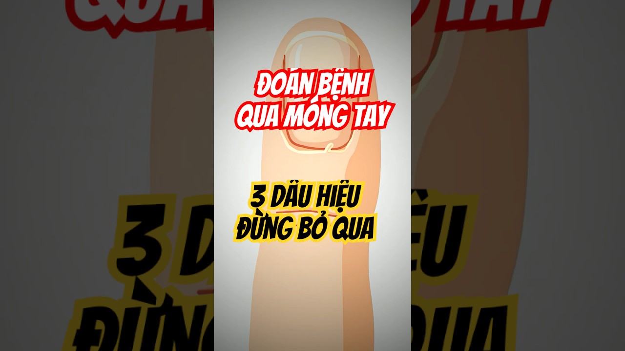 Kiểm tra móng tay phát hiện dấu hiệu gan bị tổn thương và vàng nhợt