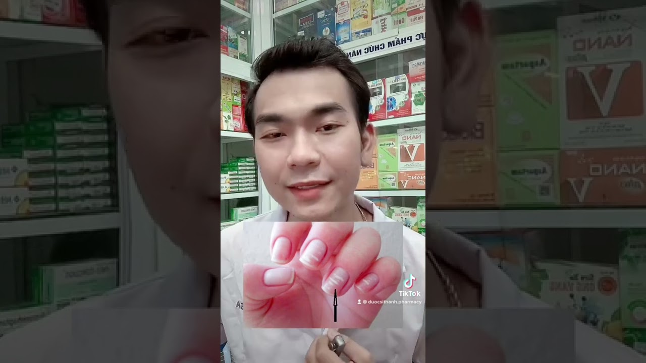 Mô tả các dấu hiệu móng tay bất thường như móng vàng, móng giòn, chỉ dấu sức khỏe toàn thân.