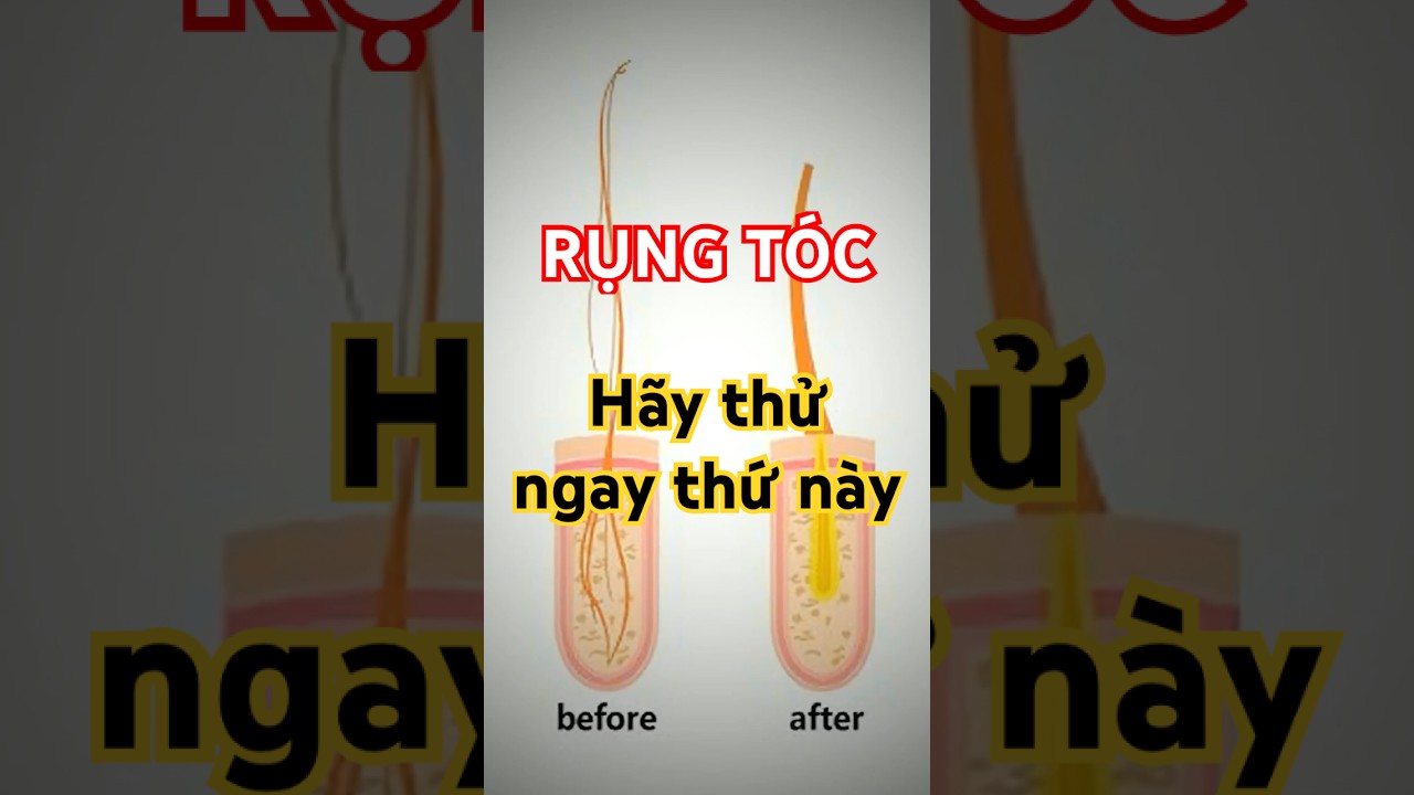 Bát đậu đen rang là giải pháp tự nhiên giúp giảm rụng tóc nhiều ở tuổi trung niên