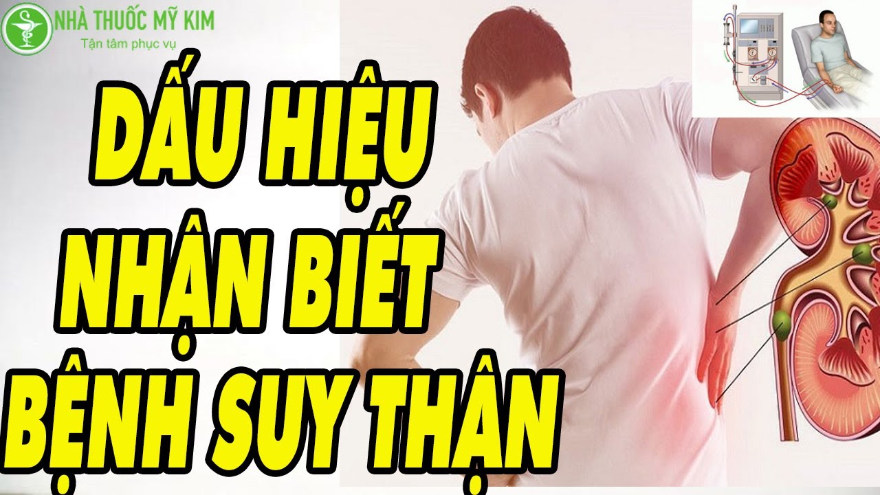 Mô hình giải phẫu thận người, minh họa chức năng lọc máu và tầm quan trọng của việc bảo vệ sức khỏe thận.
