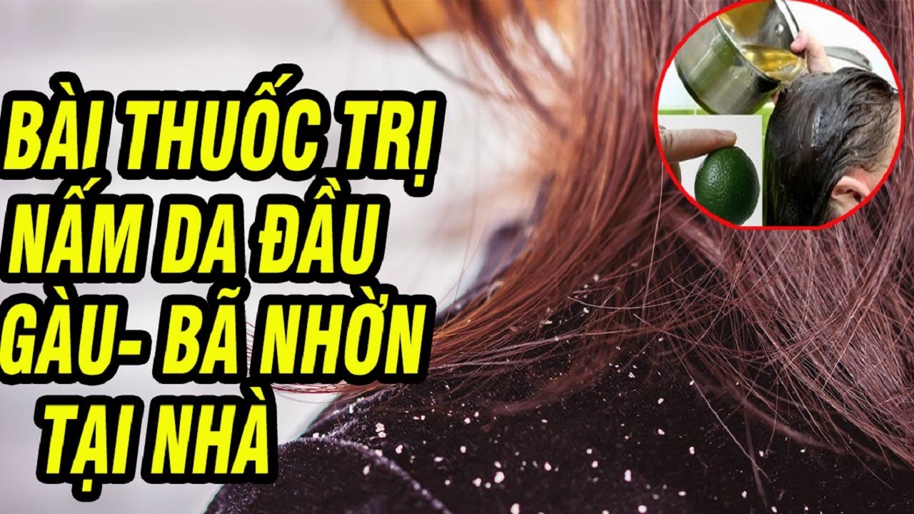 Quy trình chăm sóc da đầu chữa nấm da đầu và giảm gàu hiệu quả tại nhà