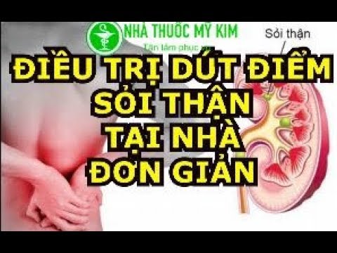 Hình ảnh minh họa cơ chế hình thành và triệu chứng sỏi thận