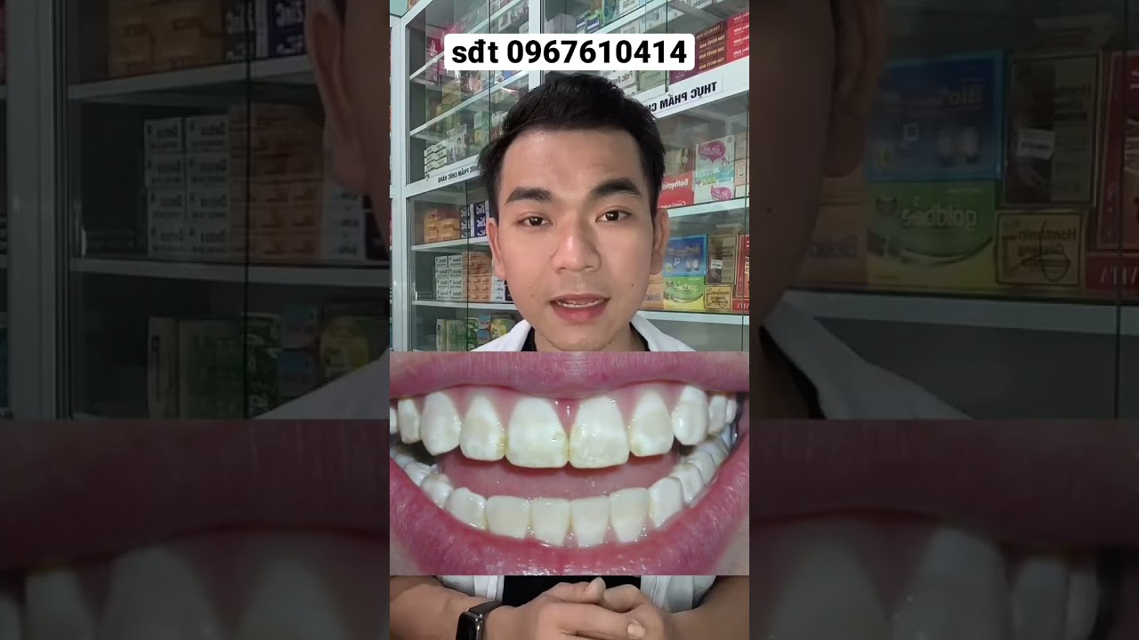 Hình minh họa cấu trúc khoang miệng giúp hiểu rõ nguyên nhân và cách điều trị hôi miệng sâu răng.