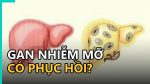 Hướng dẫn điều trị gan nhiễm mỡ độ 1 bằng chế độ ăn uống và vận động lành mạnh.
