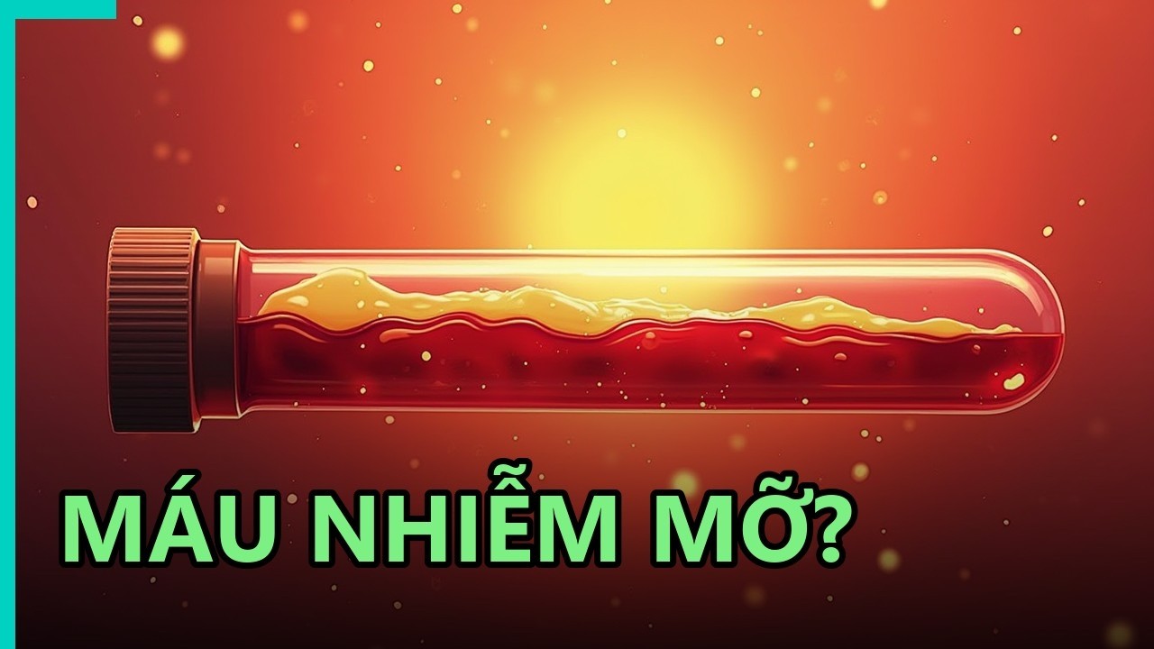 Minh họa nguy cơ mảng xơ vữa và ảnh hưởng của máu nhiễm mỡ lên hệ tim mạch.