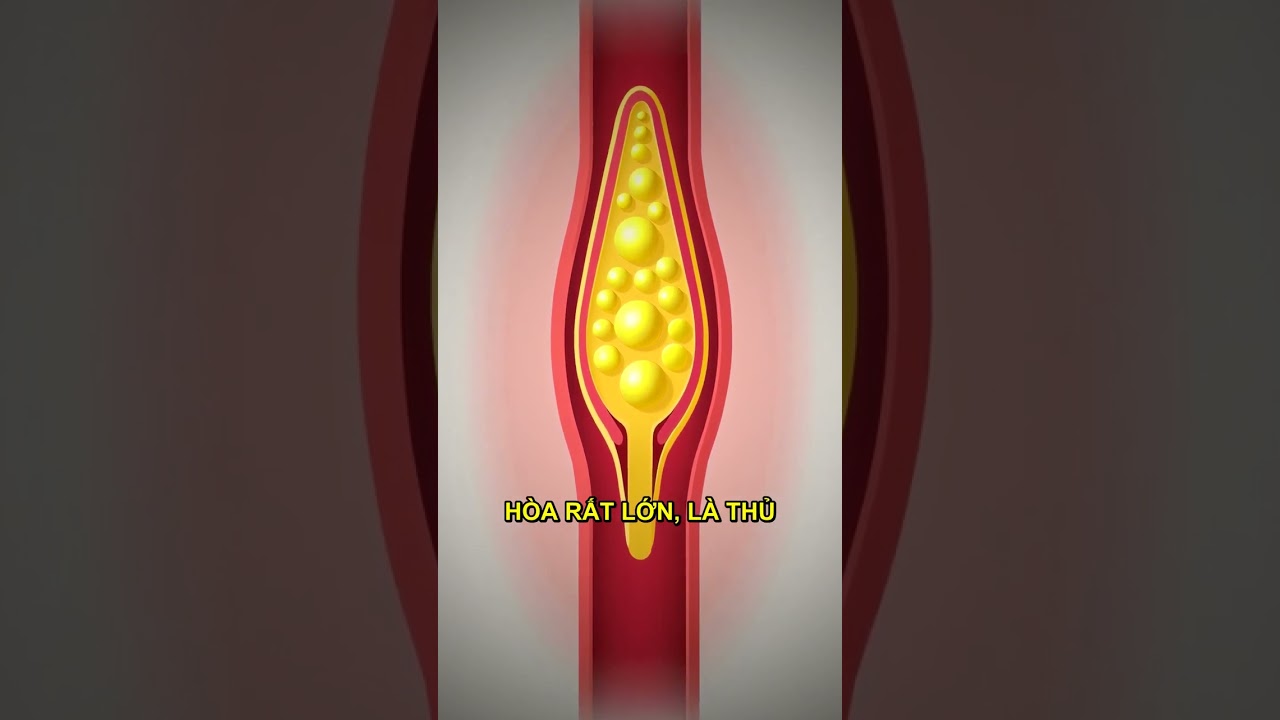 Bữa sáng lành mạnh giúp kiểm soát mỡ máu và cholesterol