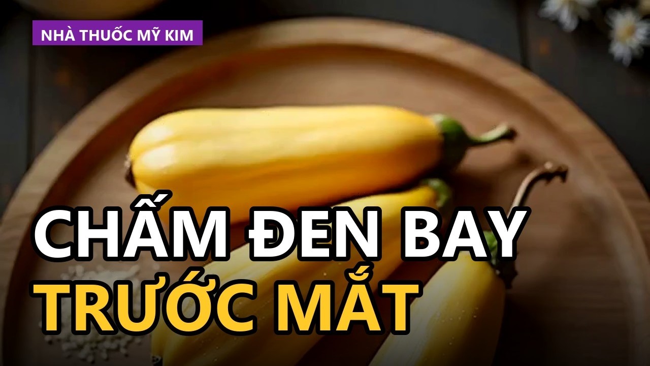 Ảnh mô tả chấm đen bay trước mắt (floaters) trong võng mạc mắt