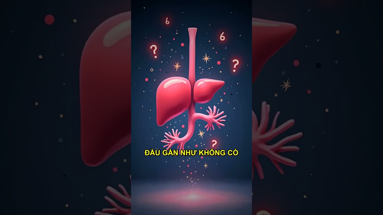 minh họa các loại thực phẩm gây gan nhiễm mỡ do chế độ ăn uống không lành mạnh