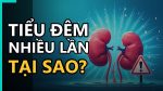 Hướng dẫn cách giảm tiểu đêm nhiều lần để cải thiện chất lượng giấc ngủ.