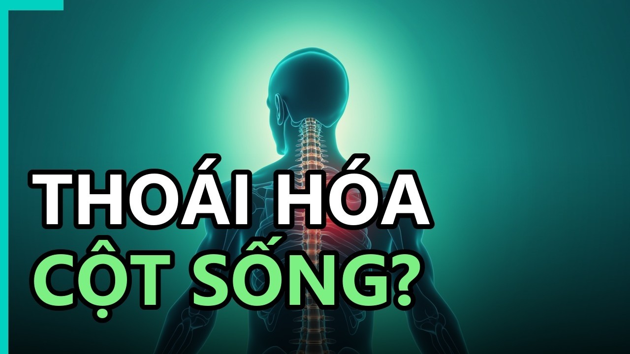 Hình ảnh mô tả cơ chế chăm sóc cột sống và phòng tránh thoái hóa cột sống đúng cách