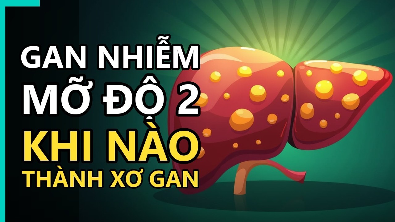 Siêu âm mô phỏng gan nhiễm mỡ độ 2 cho thấy tình trạng tích mỡ gan và nguy cơ xơ gan.