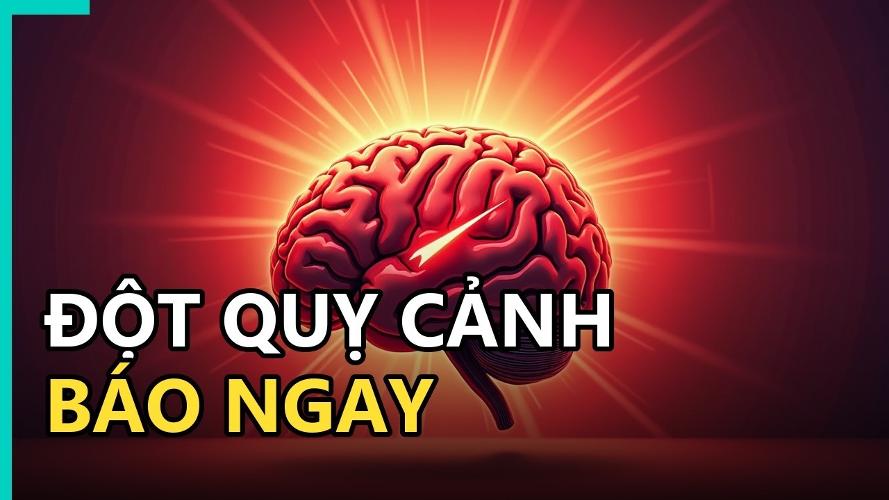 Sơ đồ minh họa dấu hiệu sớm đột quỵ và các biện pháp phòng ngừa đột quỵ.