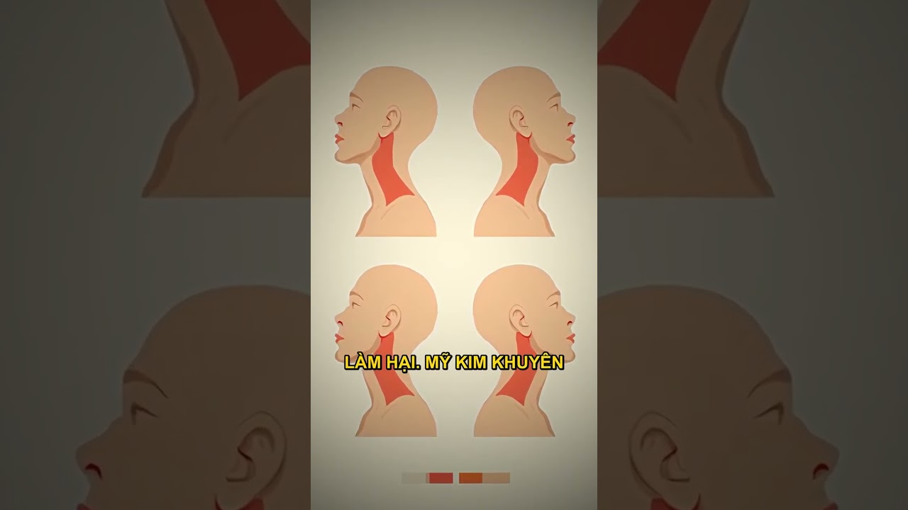 Tư thế ngồi cúi đầu sử dụng điện thoại gây đau cổ vai gáy.