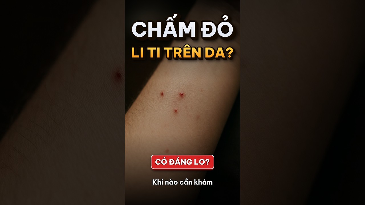 Hình ảnh mô tả tình trạng da nổi chấm đỏ li ti không ngứa cần được bác sĩ kiểm tra.